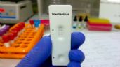 Foto ilustrativa de la nota titulada: España analiza un caso sospechoso de hantavirus y activa protocolos sanitarios