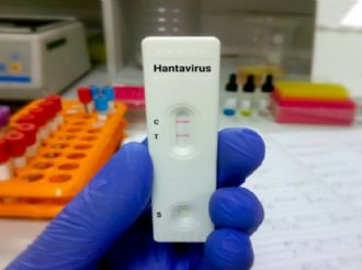 Confirman caso sospechoso de hantavirus en España