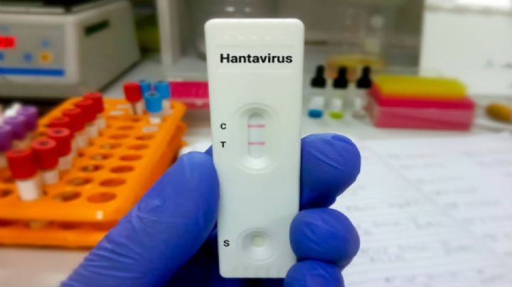 España analiza un caso sospechoso de hantavirus y activa protocolos sanitarios