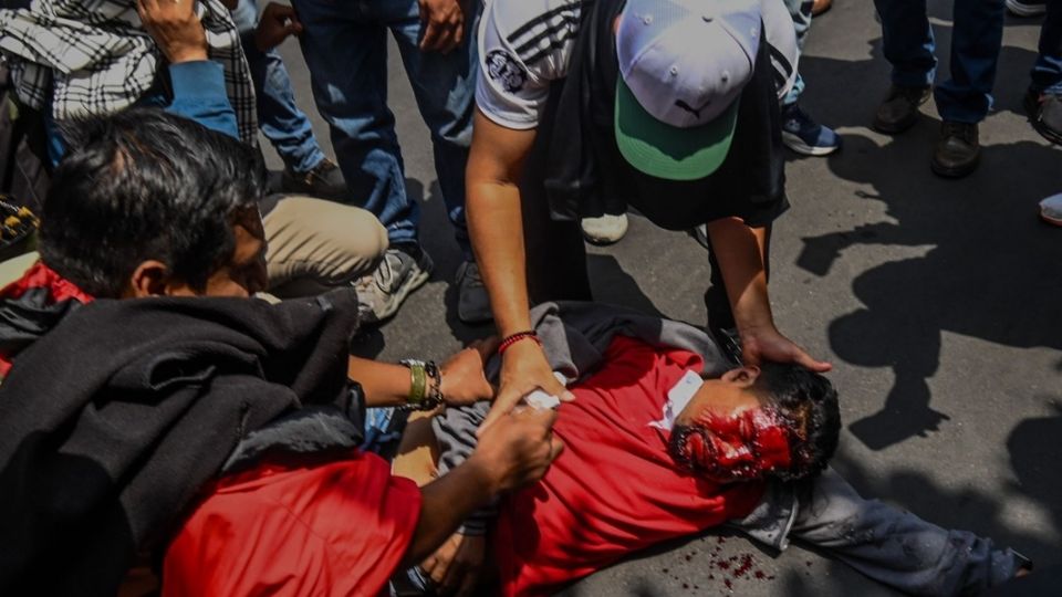 Un integrante de la CETEG recibió un golpe en la cara por un proyectil que se lanzó cerca de las vallas.