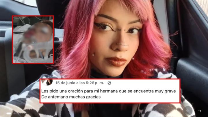 Mi hermana está muy grave: este es el estado de salud de Sandra, atacada con ácido