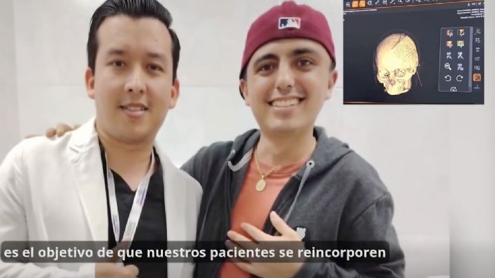 Cirugía histórica en IMSS Coatzacoalcos: reconstruyen cráneo de Eduardo, joven de 24 años