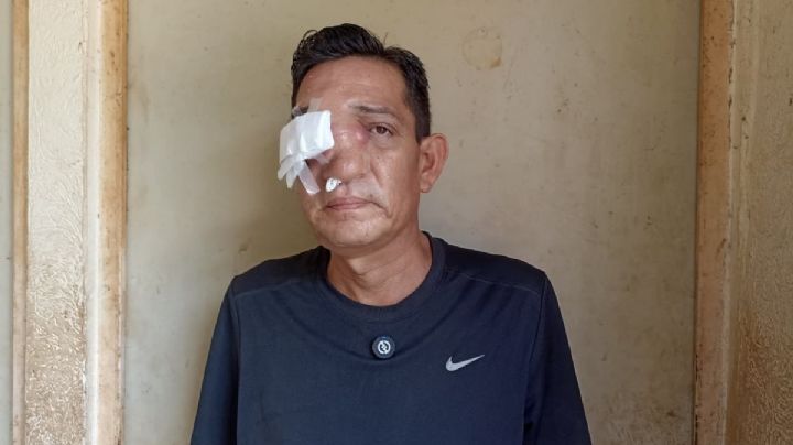 Un tumor cancerígeno cubre la cara de Sergio: clama ayuda ante falta de atención en Veracruz