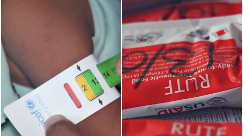 Aunque Wahida logró recuperarse, millones de menores siguen enfrentando problemas de alimentación