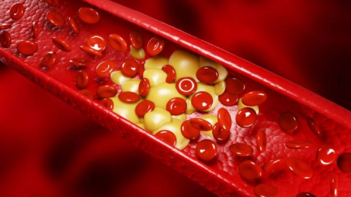 FDA aprueba una nueva pastilla para reducir el colesterol: quiénes podrán tomarla y cómo actúa