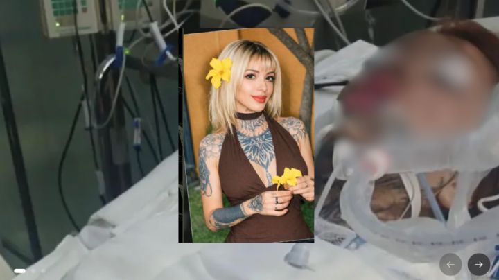 Sandi sigue luchando por su vida a un mes de ser atacada con ácido por Alison