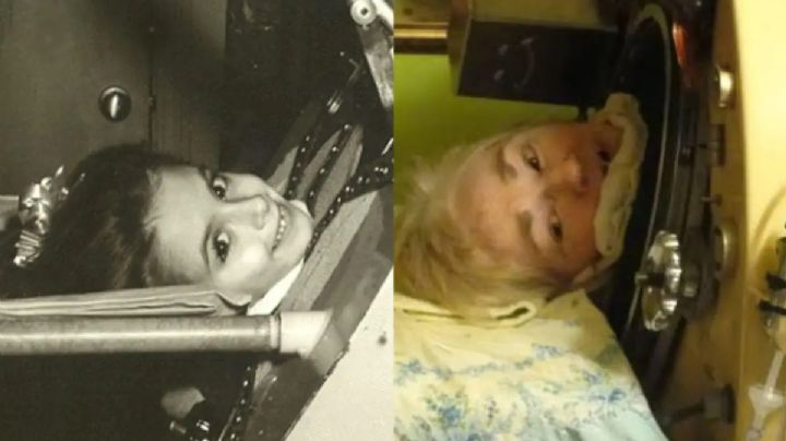 Durante 73 años una máquina la ayudó a respirar; ella nunca dejó de vivir