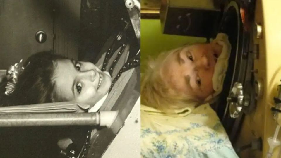 Durante 73 años una máquina la ayudó a respirar; ella nunca dejó de vivir
