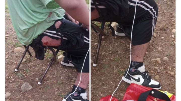Rayo impacta a dos jóvenes en la Presa La Quemada de San Felipe
