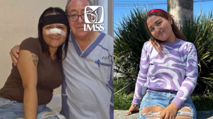 Tras accidente en Martínez, realizan reconstrucción total del rostro de Katia en el IMSS Veracruz