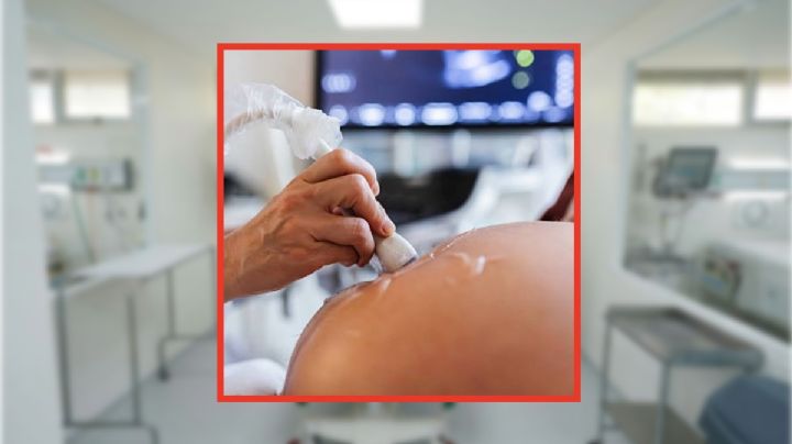 Ultrasonido de mujer con sordera y embarazada desata críticas al IMSS por presunto impedimento a su intérprete